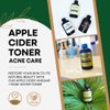 Apple Cider Vinegar + Rose Water Toner - Prevent Breakouts and Minimize Blemishes with Soothing Lavender Oil, ACV Face Toner