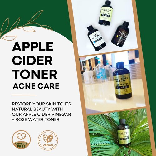 Apple Cider Vinegar + Rose Water Toner - Prevent Breakouts and Minimize Blemishes with Soothing Lavender Oil, ACV Face Toner