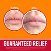 O'Keeffe's Lip Repair Lip Balm with Cherry & Vitamin E Oil; Stick (Pack of 3)