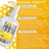 Rida Hair Research Institute Psoriasis Cream for Itchy Scalp, Face & Body | Eczema Cream for Adults | Psoriasis Treatment for Skin | Itching, Irritation & Redness Relief | XL Size