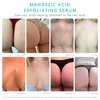Body Clearing Serum [4 Fl Oz] Level 2 Acne Serum - Advanced Formula for Body Acne, Folliculitis, Back, Butt, Chest, Thighs, Shoulders - Mandelic Acid