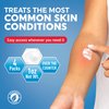 MED Pride Hydro Cortisone (Hydrocortisone) Cream 1% OTC Bulk Pack of 4 X 1 Oz Anti-Itch Ointment for Rash, Eczema, Bug Bites
