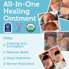 Era Organics Healing Ointment for Babies - USDA Certified Organic Natural Gentle Moisturizer for Sensitive Skin Prone To Baby Eczema, Cradle Cap (Infant Seborrheic Dermatitis), Rashes, Hives & More