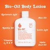 Bio-Oil Moisturizing Body Lotion for Dry Skin, Ultra-Lightweight High-Oil Hydration, with Jojoba/Rosehip/Shea Oil, and Hyaluronic Acid, 8.5 oz