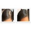 Caboki Healthful Powder Volumizer for Men & Women: Thinning Hair Solution for Root Touch Up, Hairline & Edges, Covering Hair Loss, Bald Spots & Gray Hair - TALC-Free,