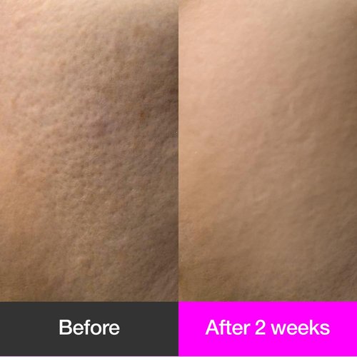 ODELOI Black Cherry Pore Tightening Cream Luftig, Pore Minimizer, Black Cherry Extract, AHA, Hydrolyzed Collagen, Korean Skincare, All Skin Types, 3.3 fl.oz / 100ml