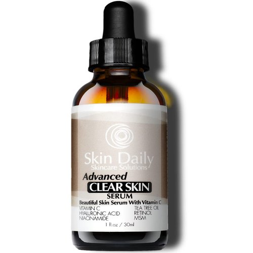 Powerful Breakout-Fighting Formula: Hydrating Vitamin C Dark Spot Serum Gentle on Skin, Suitable for Most Skin Types - Moisturizing Formula with Pleasant Scent