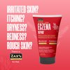 Zax's Original Eczema Repair Cream - Skin Eczema Cream for Kids & Adults - Natural Ingredients Itchy Skin Relief Ideal for Dryness, Irritation, Redness & Rough Skin (4.73 Fl Oz)