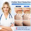 Ragkun Fast-Acting Skin Tag Remover Wart Remover with Salicylic Acid, Wart Removal for Women Men, Wart Freeze Off for Plantar Wart,Flat,Common, Corn,H Wart, Callus 30ML