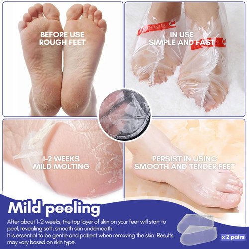 SPINOSUM Foot Peel Mask (2 Pairs) for Baby Soft Skin Remove Dead Skin, Dry, Cracked Feet & Callus, Spa, Made with Aloe Vera Extract Women and Men Peeling Exfoliating, Lavender