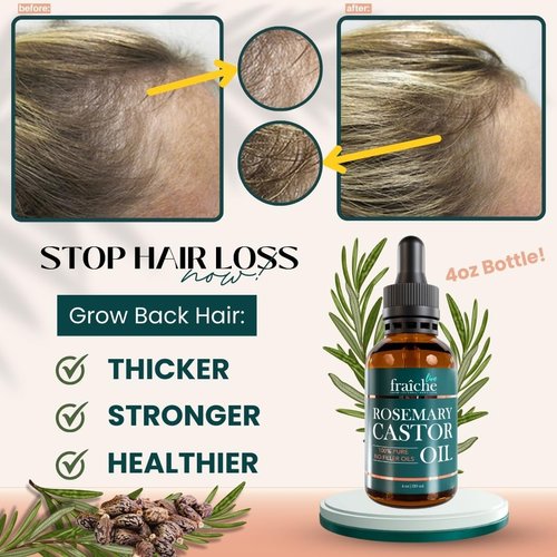 Rosemary Castor Oil for Hair Growth (4oz) - Live Fraiche Natural Hair Growth Oil - Cold Pressed Castor Oil and Rosemary Oil for Hair Growth -Strengthening Hair Oil for Damaged Hair to Reduce Hair Loss