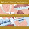 Opalescence 45% Syringes Teeth Whitening Gel - with PF - (4 Syringes) Refill Kit Carbamide Peroxide. w/Toothbrush, in Mint Flavor. Tooth Whitening 5359-2T