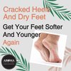 AROMA DEAD SEA Shea Butter Foot And Nail Cream Nourishing And Repair Damaged Skin. Enriched With Tea Tree Oil, Vitamin E And Wheat Germ Oil. Improves Skin Elasticity. (3.5 Fl.oz) (Pack Of 1)