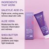 Seroflora Butt & Thighs Acne Treatment Cream - Butt Acne Clearing Cream for Pimples, Zits, Razor Bumps, Dark Spots - Acne Clearing Lotion for Buttocks & Body - Inner Thigh Blackhead Remover (4oz)
