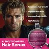 HairSmart Ayurvedic Growth Accelerator Hair Serum Reduces Shedding, Enhances Density & Soothes Scalp- Non-Greasy Scalp Serum for Thinning Hair Growth Serum & Hair Regrowth Treatment for Women 100 ml