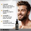 Minoxidil for Men, Minoxidil for Men Beard Growth Kit, Minoxidil for Women Hair Growth Kit, Hair Regrowth for Men, Beard Growth Serum, Minoxidil 5 Percent