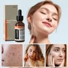 Vitamin C Face Serum, Hydration Facial Serum with Hyaluronic Acid, Vitamin E, Collagen & Niacinamide - Brightening Serum for Dark Spots, Even Skin Tone, Wrinkles, Fine Lines for Skin Care Essence