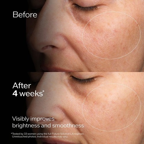 Shiseido Future Solution LX Concentrated Brightening Softener Refill - 170 mL - Anti-Aging Facial Lotion - Smooths & Clarifies Skin - All Skin Types - Non-Comedogenic