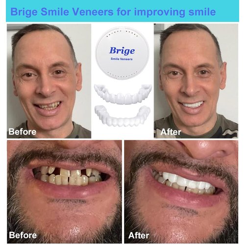 Brige Smile Teeth Denture Temporary False Teeth Improve Smile