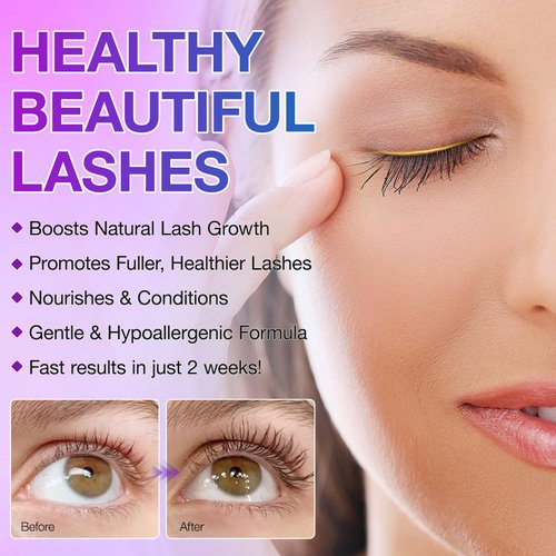 Eyelash Growth Serum, Advanced Lash Serum for Eyelash Growth, Women Eyelash Serum - Promotes Longer, Fuller and Thicker Lashes in a Month (5ml)