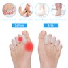 COOLWAVE Toe Separator Toe Spacer for Men and Women, Toe Straightener for Hammer Toes, Bunions, Plantar Fasciitis, Hallux Valgus (1 Pair) (Small)