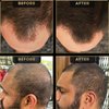 Hairline Powder by The Beard Struggle, Root Touch Up Hair Color, Hair Concealer for Men Instantly Conceals Hair Loss, Baldr's Arrow - Covers Thin Hair & Bald Spots - Sweat Resistant - Dark Brown