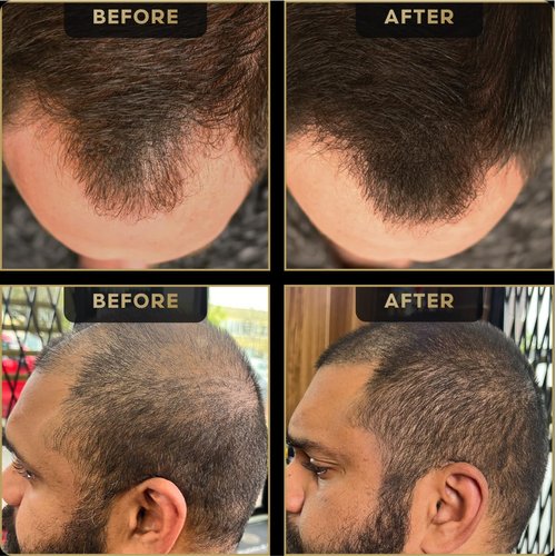 Hairline Powder by The Beard Struggle, Root Touch Up Hair Color, Hair Concealer for Men Instantly Conceals Hair Loss, Baldr's Arrow - Covers Thin Hair & Bald Spots - Sweat Resistant - Dark Brown