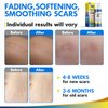 Scar Cream,Active Silicone Dimethicone Scar Gel-Advanced Repairing New Old Scars for Surgical Scars,Stretch Marks,Burn,Keloid,C-Section,Acne Treatment,1.76oz (50G)