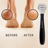 50 Blades + Facón Professional Pedicure Callus Shaver Remover - Premium Salon Quality Surgical Grade Stainless Steel - Removes Calluses, Corns & Rough Skin