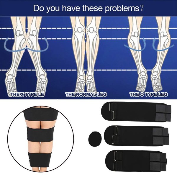 zjchao Leg Correction Belt, Professional Posture Corrector X/O Form Leg Correction Belt Bow Leg Correct Band (XL)
