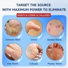 Ragkun Fast-Acting Skin Tag Remover Wart Remover with Salicylic Acid, Wart Removal for Women Men, Wart Freeze Off for Plantar Wart,Flat,Common, Corn,H Wart, Callus 30ML