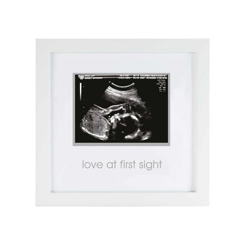 Pearhead Love at First Sight Sonogram Picture Frame, Gender Neutral Ultrasound Keepsake, Ideal Pregnancy Gift, Baby Shower and Nursery Decor, 4”x3” Photo Insert, White