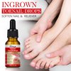 2PCS Ingrown toenail drops,Ingrown Toenail Relief,Easy Trim Ingrown Toenail Tools,Toenail Fluid With Silicone Gel Toe Caps Essential Oil Diffuser,Ingrown Toenail Reliever and Softener Kit