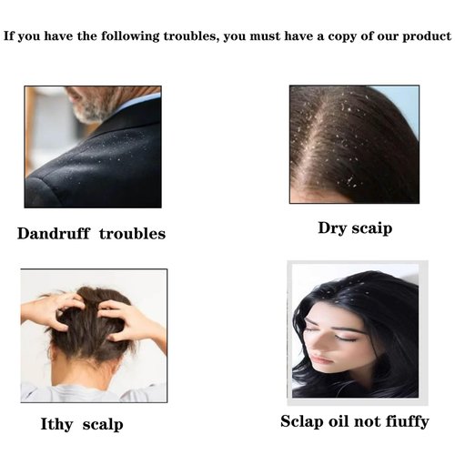 KFASANOMDZ Hair Comb, Dandruff Removal Comb Plastic, All Hair Types, Manual, for People with Dandruff Problems