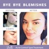 Belli Skincare Acne Control Spot Treatment - Skin Care Treatment - Acne Treatment - Vegan Face Wash - Pregnancy Acne Treatment - Acne Spot Treatment for Face - Face Care