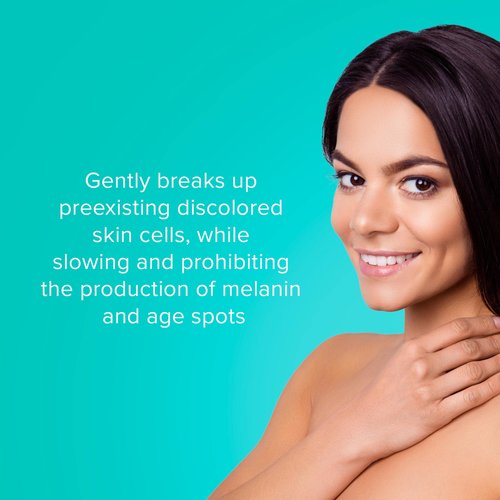 ClarityRx Brighten It 10% Lactic Acid Solution, Natural Plant-Based Exfoliating Face Treatment for Dark Spots, Discoloration & Uneven Skin (2 fl oz)