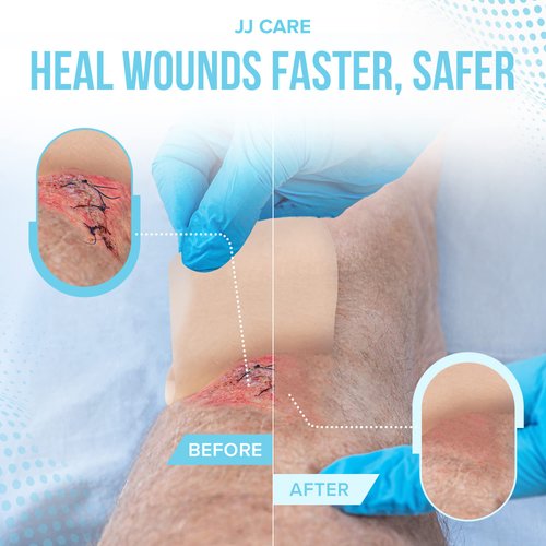 JJ CARE Hydrocolloid Dressing 2x2 [Pack 10], 0.8MM Thick Hydrocolloid Bandages with Border, Self-Adhesive Thin Hydrocolloid Wound Dressing, Wound Care Bandages for Bedsores and Blisters