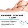 Acanthosis Nigricans Cream, Nigrifree Acanthosis Nigricans Cream, Repair Cream Hydrating Moisturizers Cream 50 g*2 pcs