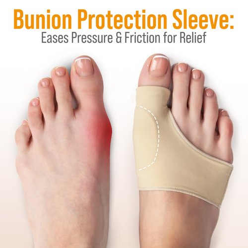 5 STARS UNITED Bunion Relief Sleeve with Gel Cushion – 2-Pack Hallux Valgus Cover for Men and Women - Toe Spacer Socks with Pads for Comfort and Protection
