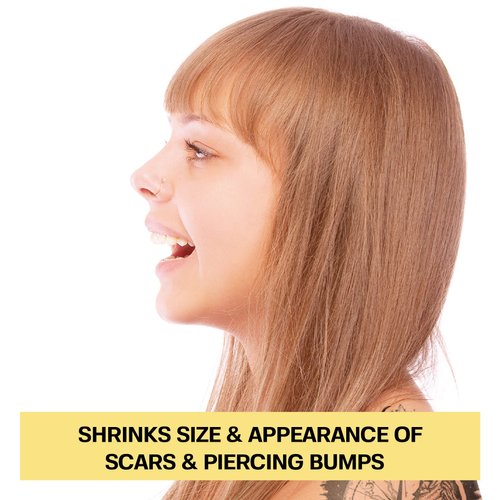 BASE LABORATORIES Piercing Bump Solution & Keloid Bump Removal | Soothing Piercing Aftercare for Piercing Bumps & Keloid Scar Removal | Ear & Nose Keloid Bumps Piercing Aftercare Solution Oil | 0.5 oz