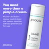 Proactiv - Benzoyl Peroxide Face Wash and Acne Treatment - Daily Facial Cleanser and Hyularonic Acid Moisturizer with Exfoliating Beads - 60 Day Supply, 4 Oz