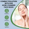 SBS STOW BULK SUPPLY Acne Foaming Face Wash — Oil-Controlling Facial Cleanser for Blackheads & Pimples — Gentle & Moisturizing Facewash to Reduce Redness (150g/5.3oz)