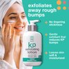 TOUCH Glycolic Acid Lotion for Keratosis Pilaris - KP Lotion Moisturizer - Glycolic Acid Body Lotion for AHA BHA Rough & Bumpy Skin- Keratosis Pilaris Exfoliating Lotion Gets Rid Of Redness - 8 Fl Oz