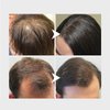 Rice Water for Hair Growth, 1.01oz Rice Water Hair Serum - Fermented Rice Water Shampoo and Conditioner Rich In Vitamins B1 and B2, Moisturizing, Nourishing, Smooth Hair (Essence)