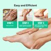 SilkySecret Callus Remover Gel for Feet (8.45 fl.oz), Powerful Formulation Foot Callus Remover, Extra Strength Callus Remover, Callus Remover for Feet Gel, Calloused Feet Remover Gel for Home Use