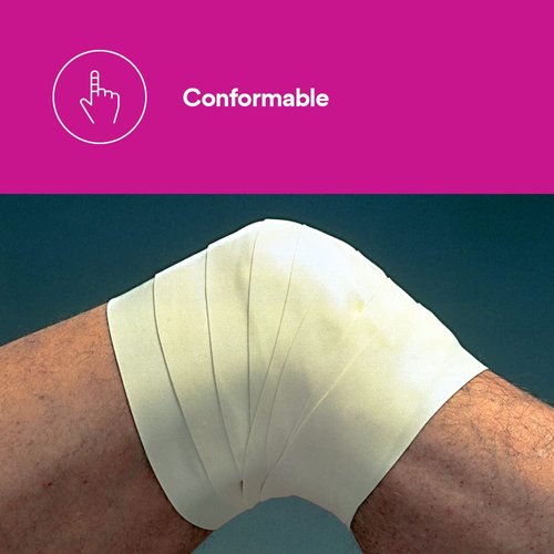 3M™ Microfoam™ Surgical Tape, 1528-4, 4 inch x 5 1/2 yard (10cm x 5m), Stretched, 3 Rolls/Carton, 6 Cartons/Case