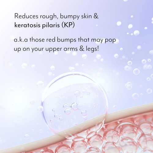 Bliss Body Butter Texture Takedown Skin Smoothing Lotion - Keratosis Pilaris KP - 6.7 Fl Oz - For Rough, Bumpy Skin - 10% AHA + Squalane + Shea Butter - Clean - Vegan & Cruelty-Free