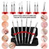 Blackhead Remover Tools, Blackhead Extractor, 6 Pack Pimple Popper Tool Kit for Removing Blackhead, Whitehead, Pimple, Acne, Zit, Comdone, Pores, Fat Granules on Nose, Face - with Organized Case
