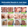 CHARMPOO Antifungal Cream for Foot and Body: Fast Relief Athlete's Foot Jock Itch Psoriasis Ringworm Eczema Rashes - Powerful Herbal and Miconazole Formula 30g(Pack of 1)
