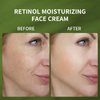 Face Moisturizer Retinol Cream, Anti Aging Moisturizing Face Cream with Vitamin E, Hyaluronic acid,Organic Aloe Vera Day & Night Anti Wrinkle Cream,Skin Care for Women & Men,30ml/1 Oz